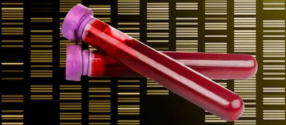 NHS cancer screening blood test