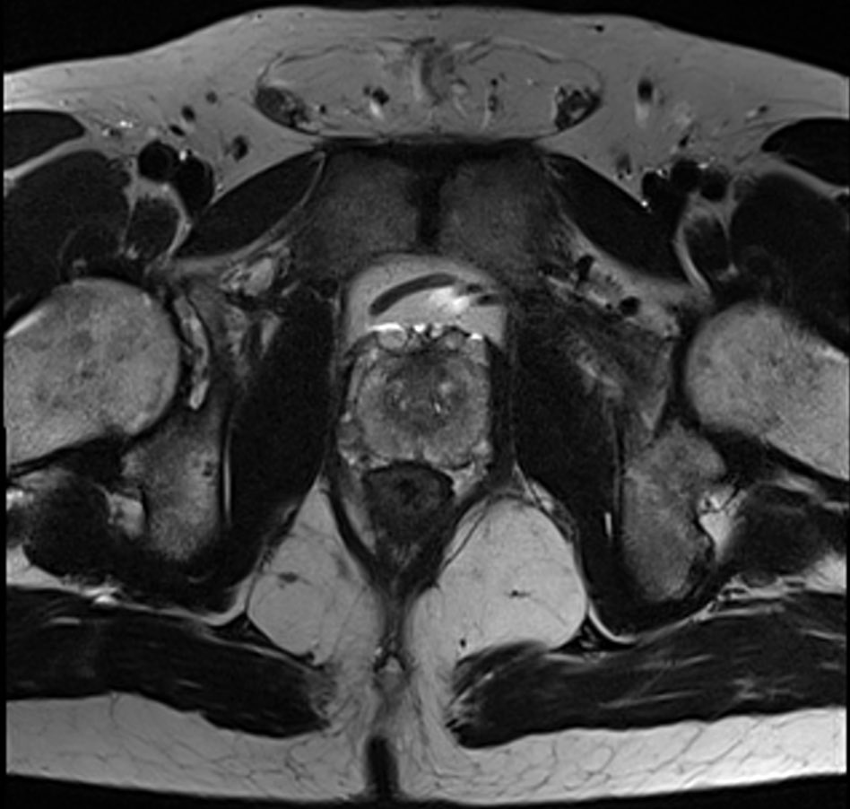 Stump tumor prostate mri, Items where Year is - Repository of the Academy's Library