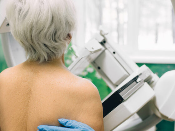 Senior woman having a mammography scan at hospital