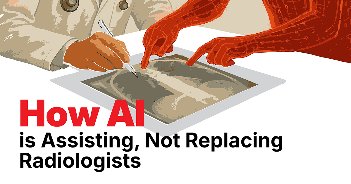 How AI is Assisting, Not Replacing Radiologists
